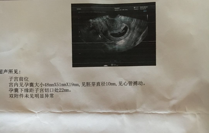 去香港验血查胎儿性别需要什么条件,性别鉴定是男孩会翻盘么!