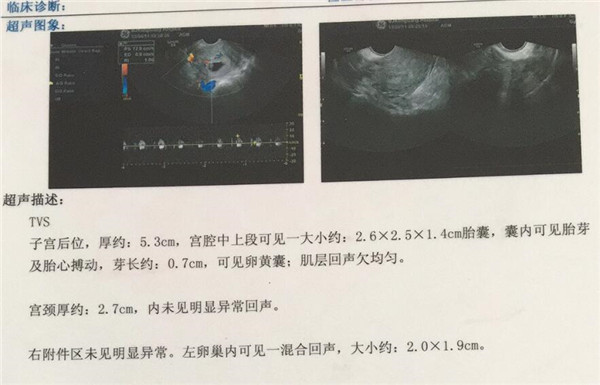 香港验血报告单都不一样吗_性别鉴定六周和七周哪个更准？