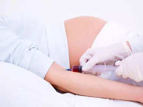 香港八周验血知男女准吗要怀孕多少天,希望能对大家有帮助