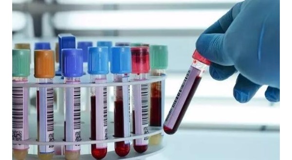 香港验血鉴定性别哪家化验所最准，多少钱，真的权威吗？