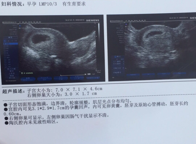 赴香港查胎儿性别,预约香港验血需要什么流程!